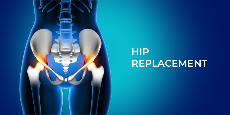 Hip Replacement Surgery