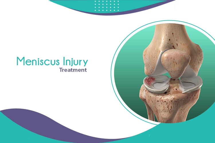 Meniscus Injury